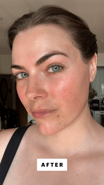 Dall'Asen after applying the Shani Darden Signature Nourishing Facial Mask